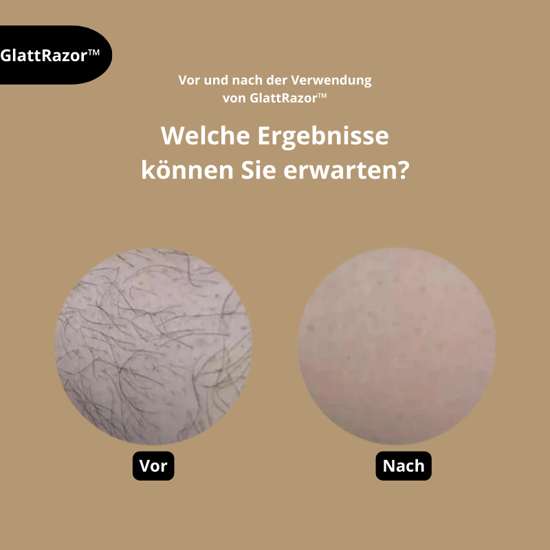 GlattRazor™ | Unverzichtbar